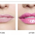 lip-plumper-for-attractive-lips